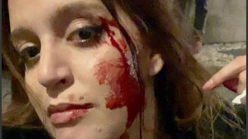 Brasileira relata ter sido agredida por quatro portugueses em Lisboa: ‘Impunidade total’