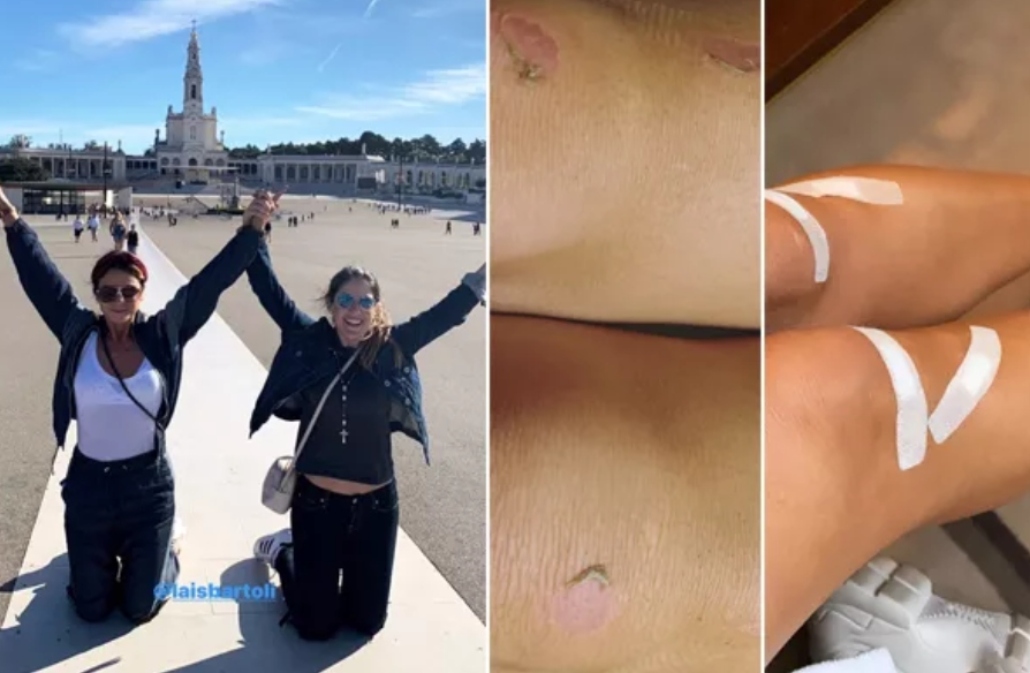 Giovanna Antonelli mostra joelhos machucados após pagar promessa em Portugal